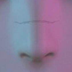 Scars and Nose